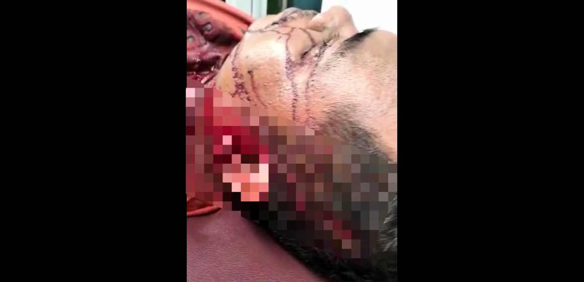 Kepala Korban Digergaji Langsung Mengadu Ke Polrestabes Medan